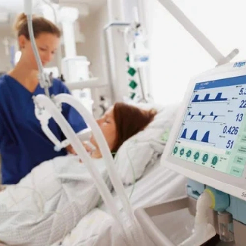 The Drager Savina 300 Ventilators